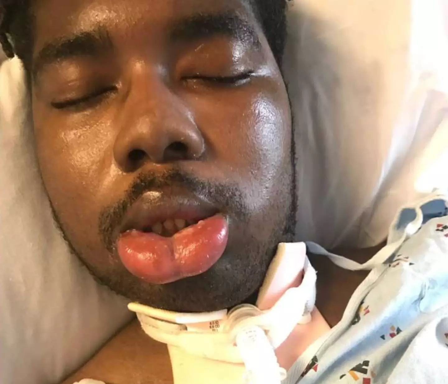 NJ remains in a vegetative state.