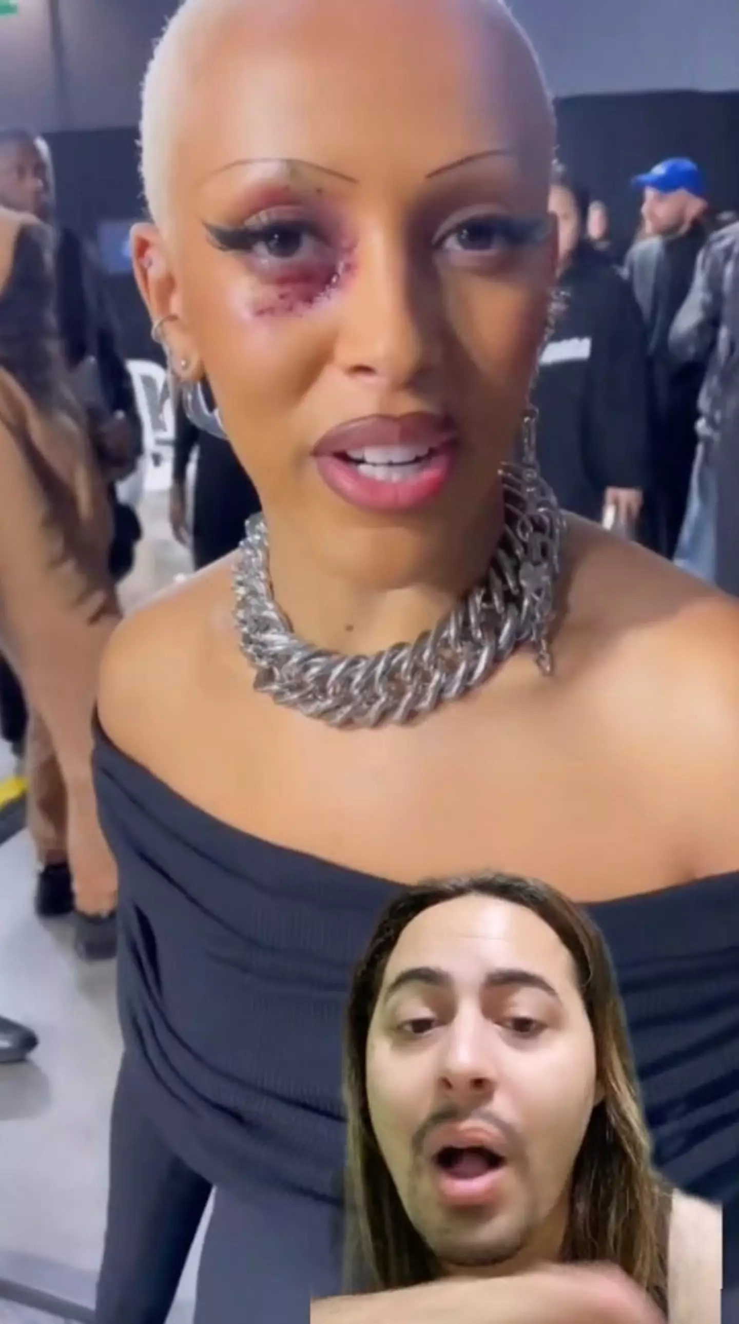 Her 'purple eye' make-up has been the source of speculation.