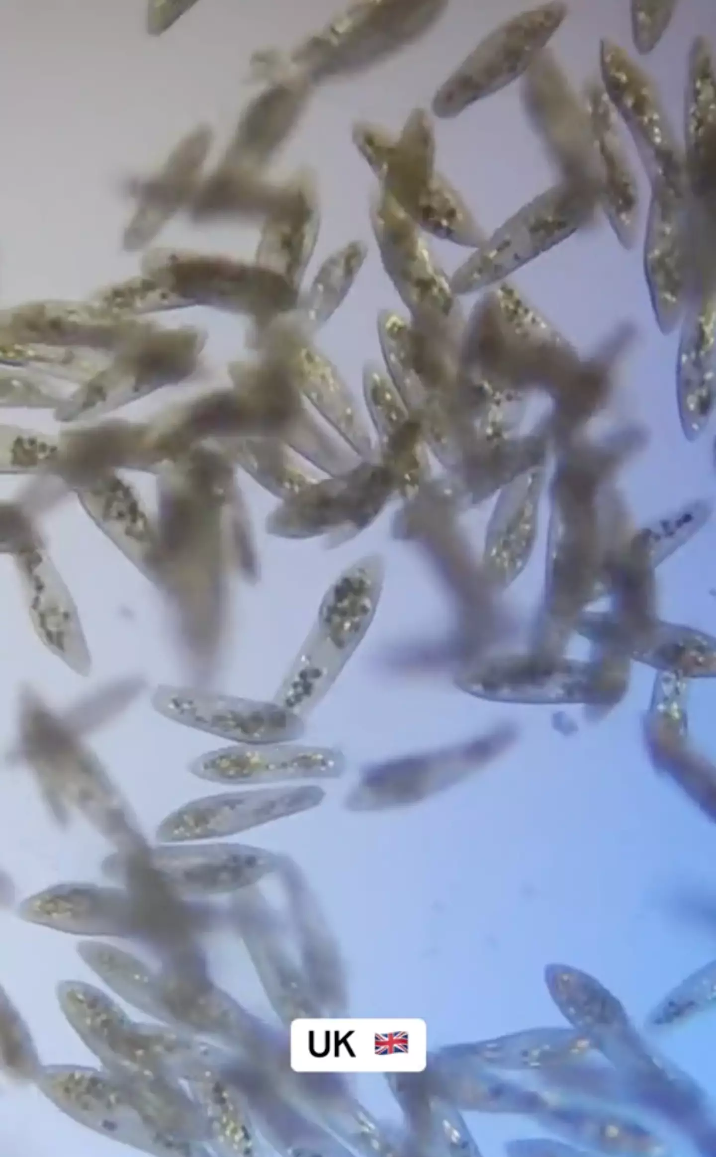 The UK had a lot more critters, but seemingly smaller and simpler. (TikTok/@microscope.vision)