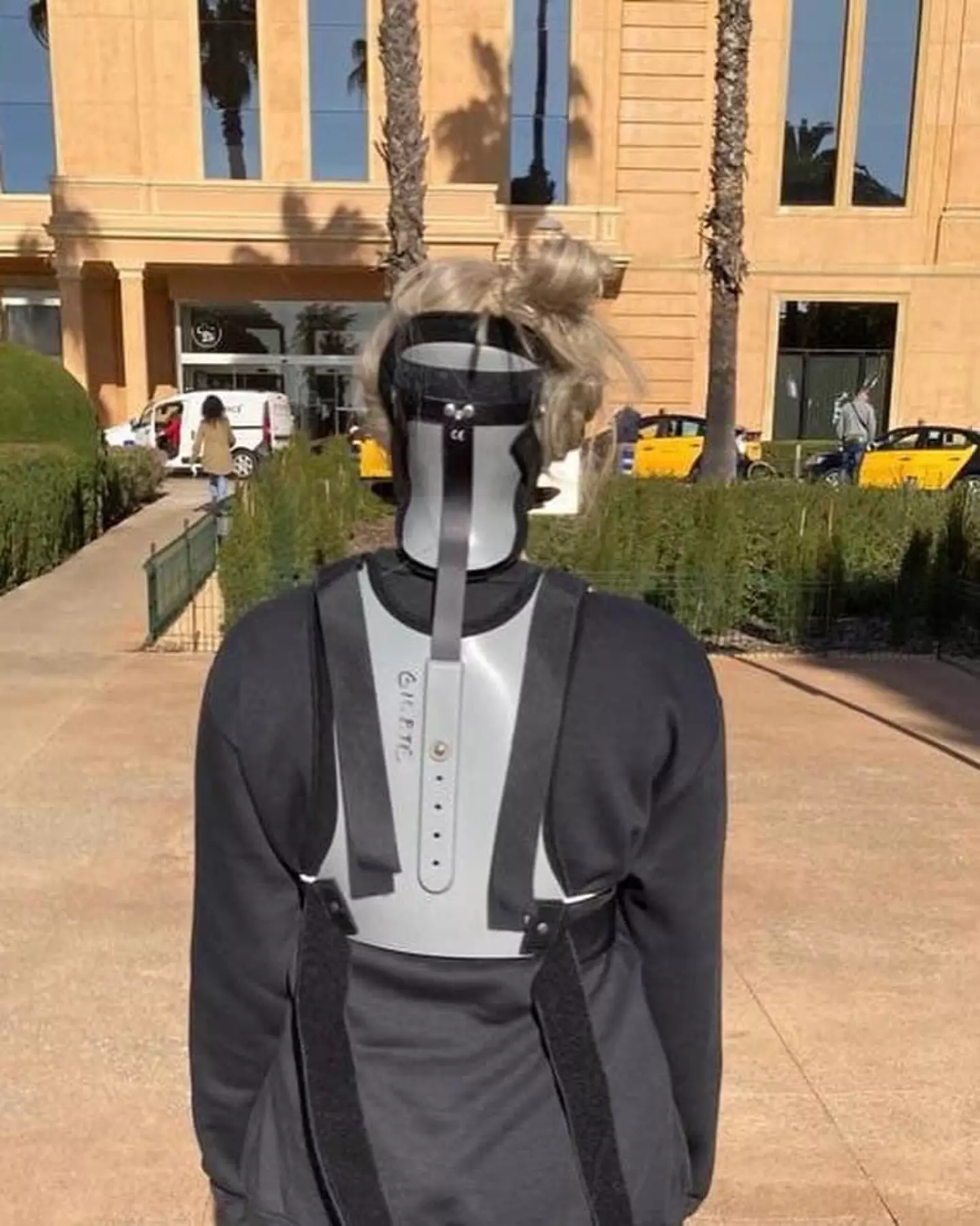 Amy was diagnosed with craniocervical instability in 2022 (PA Real Life)