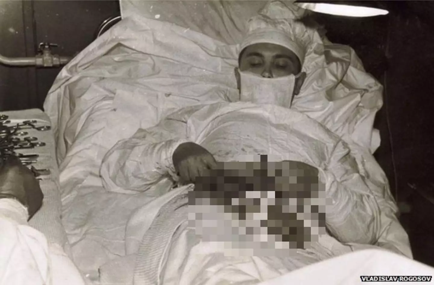 Rogozov carried out his own appendectomy (Vladislav Rogozov)