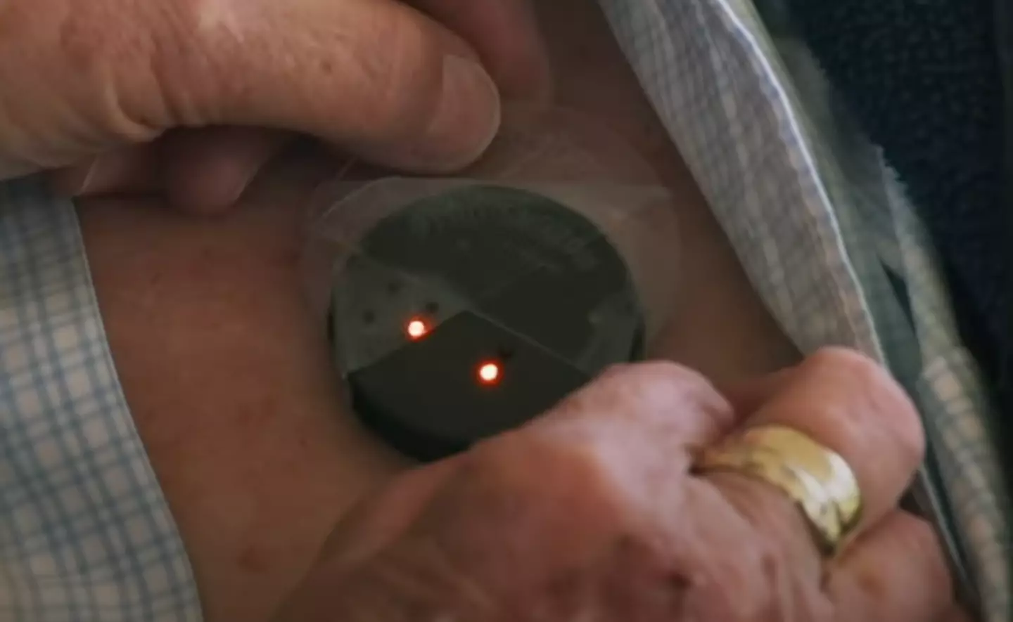 The device links to the switch on the chest.