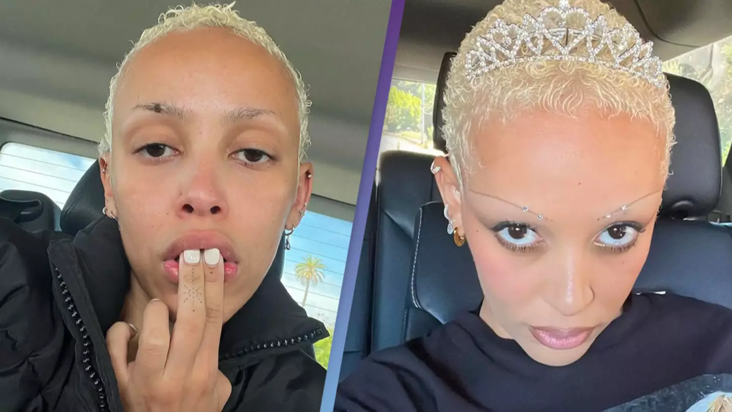 Doja Cat's brother accused of knocking out her teeth, court filing claims