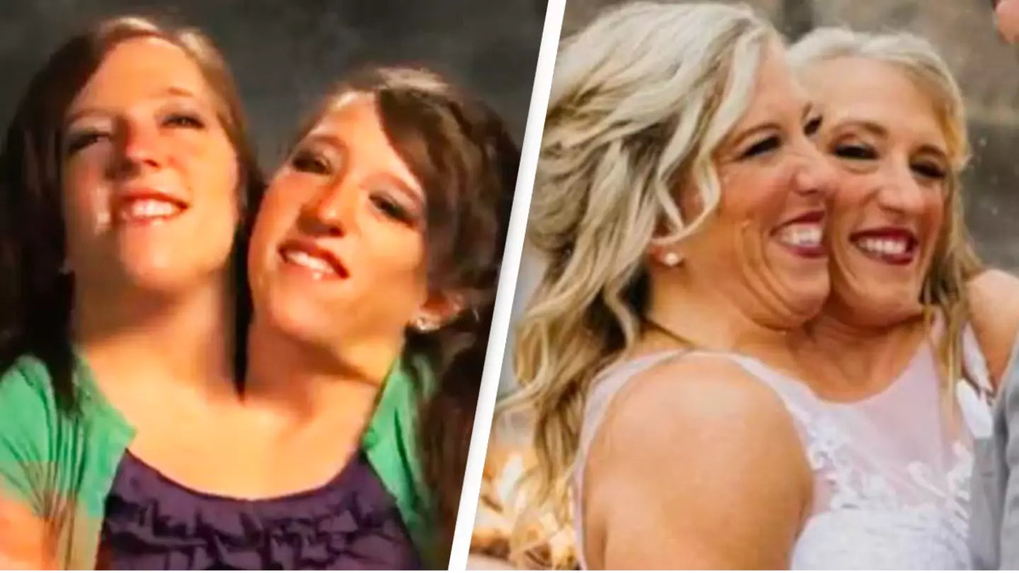 Conjoined twin Abby Hensel is now married