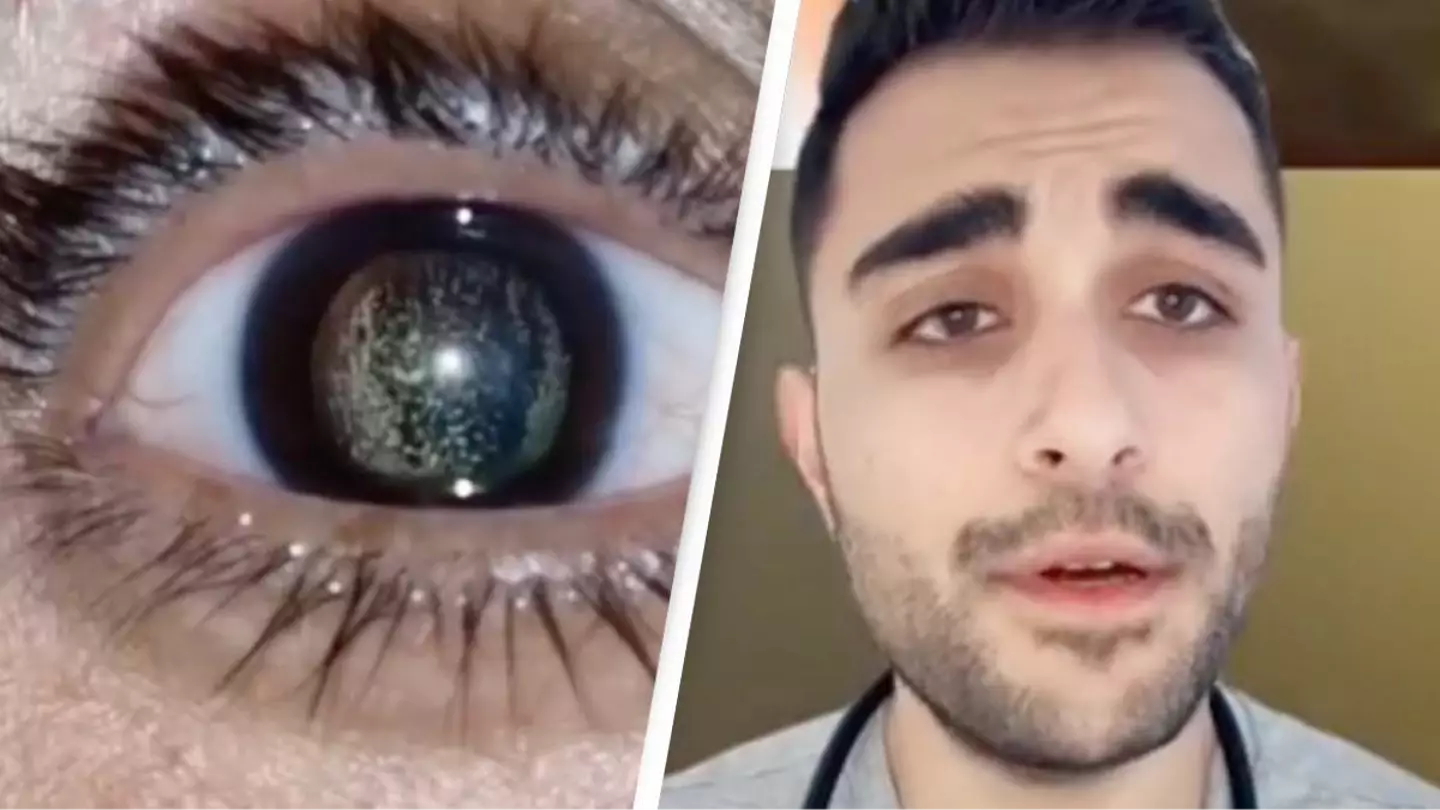 Doctor reveals symptom of bizarre condition that makes your eyes look like the night sky