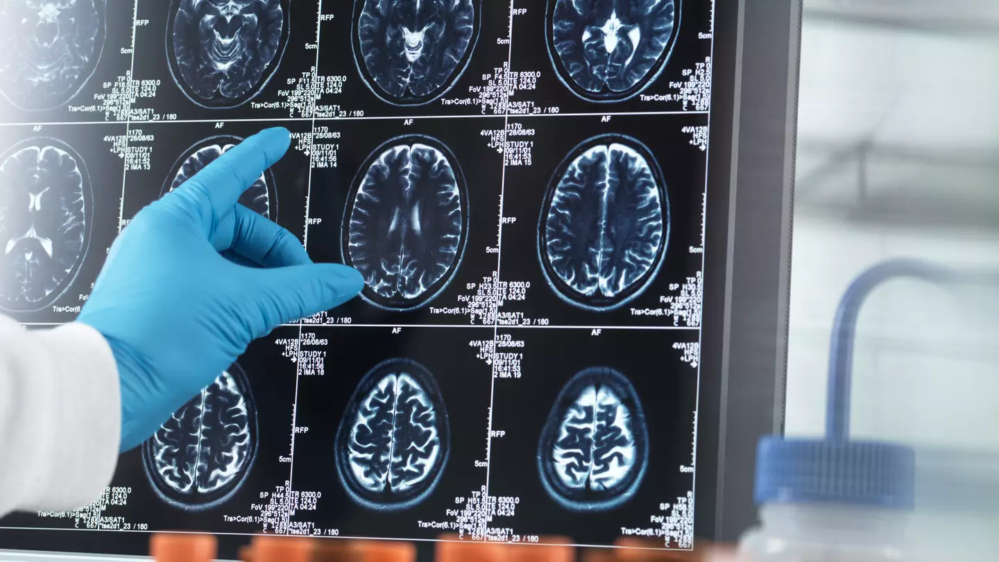 Study reveals the one activity that can delay dementia by 5 years and reduce risk by 38%