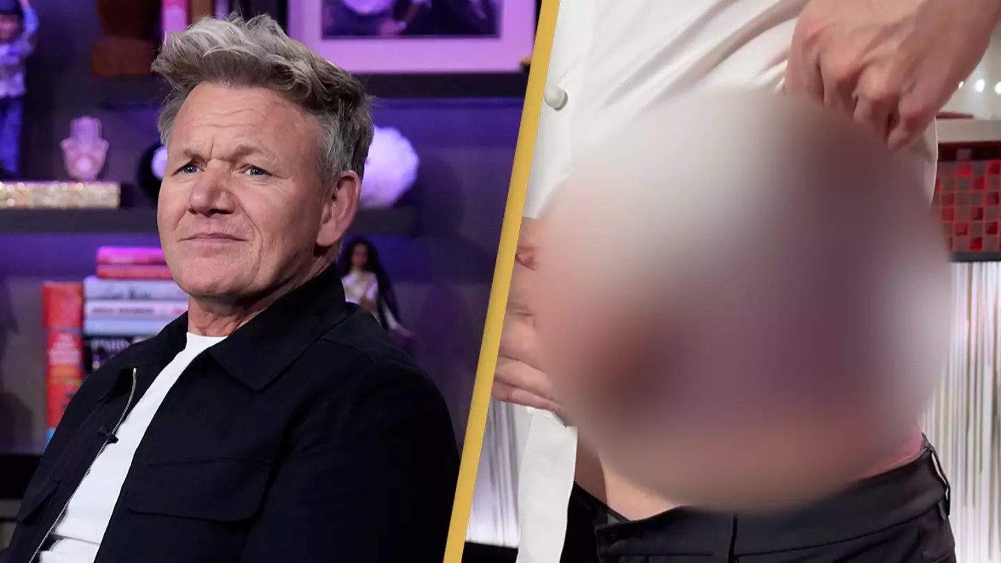 Gordon Ramsay details exactly what happened in bike accident that caused horrific injuries