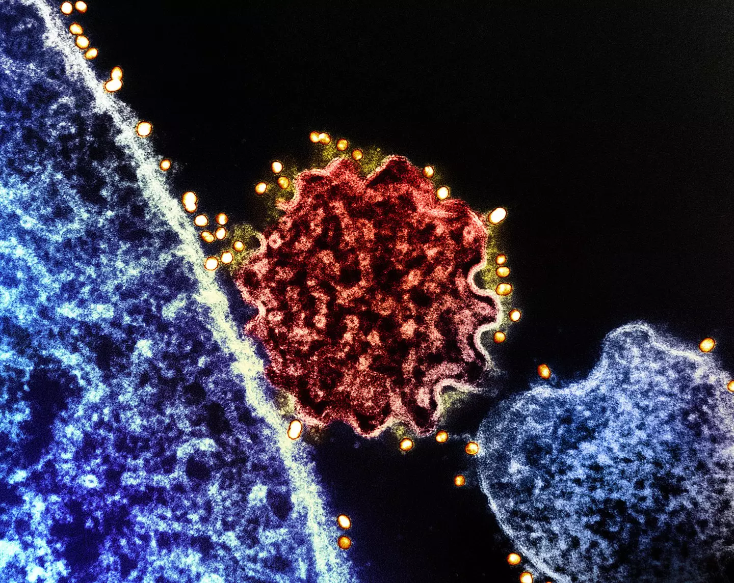 Dr Seethu Ponnu Thampi has dealt with an outbreak of the virus before (NIH-NIAID/Image Point FR/BSIP/Universal Images Group via Getty Images)