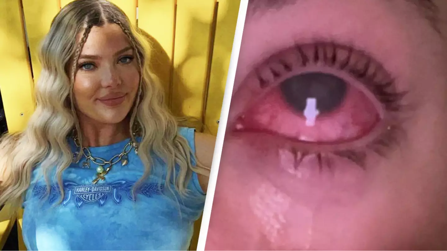 Woman goes blind after ‘grain of sand’ in her eye turns out to be something far more sinister