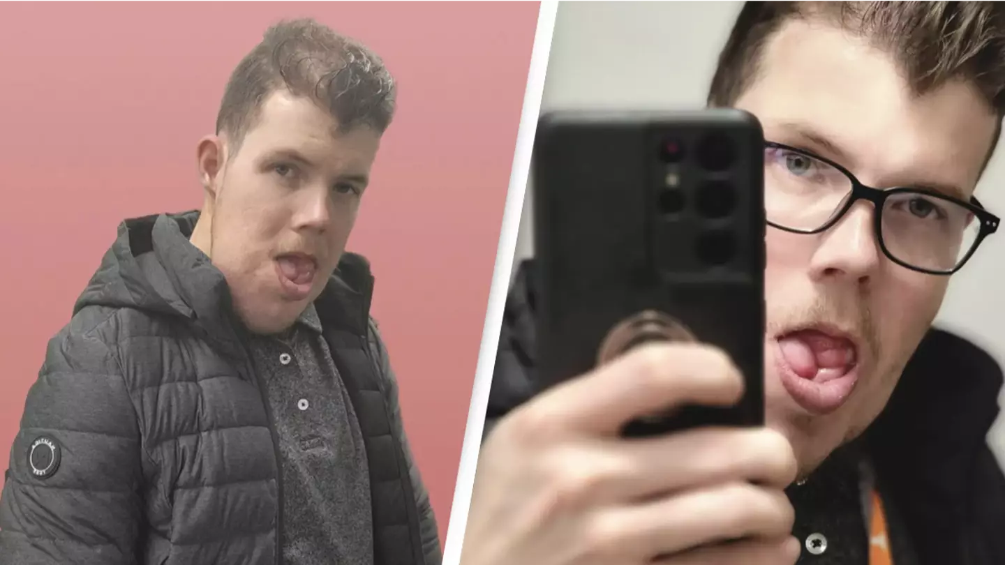 Man Born With Rare Condition Forced To Choose Between His Voice Or Face