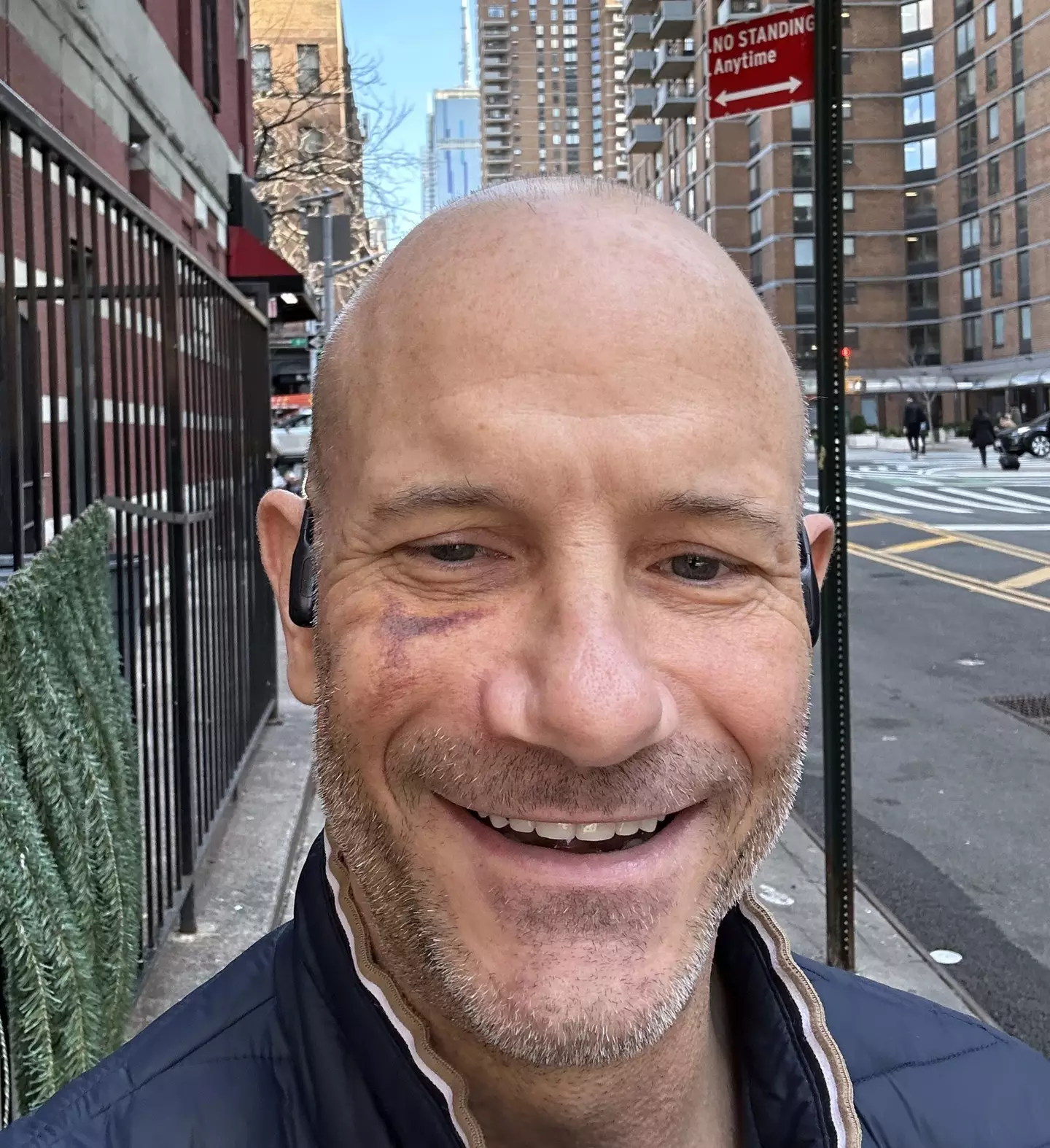 Eric is crediting the Apple Watch for saving his life. (Kennedy News and Media)