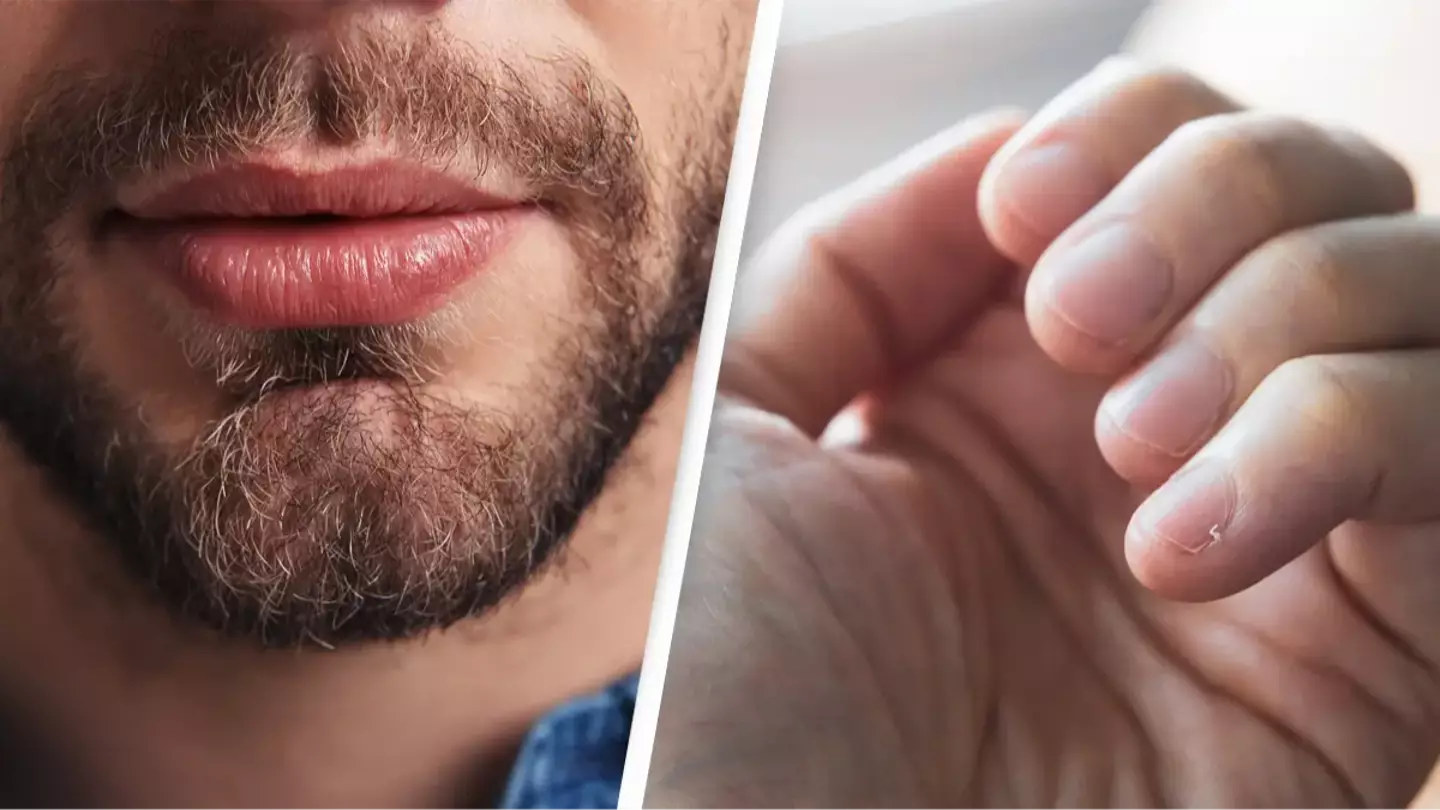 Doctor reveals little known signs of deadly cancer that you can see on your lips and nails