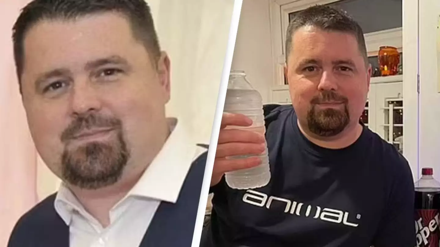 Man reveals shocking changes to his body after drinking 5 liters of soda per day and not drinking water