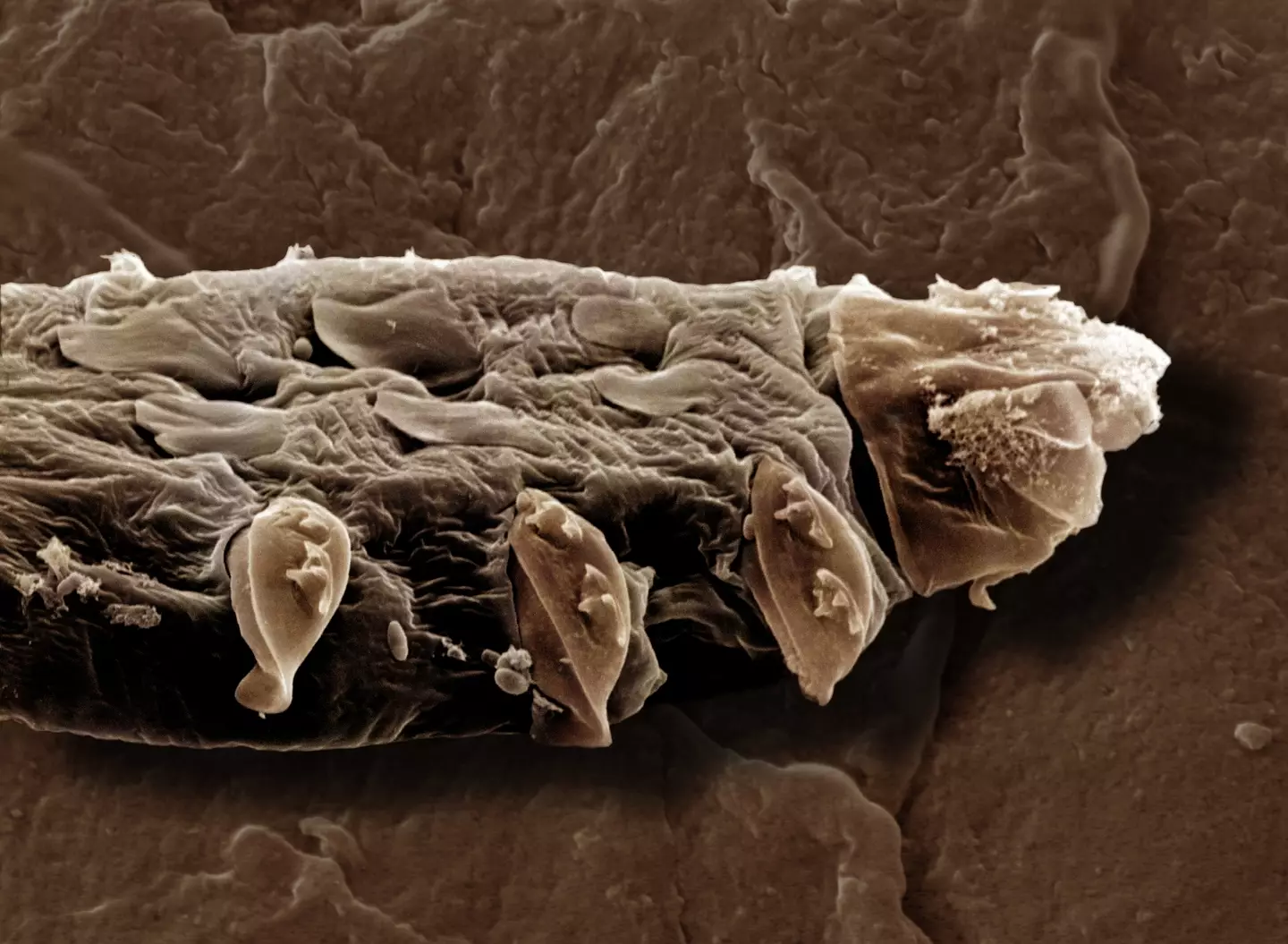 The mites are found everywhere around your body (Getty Stock Photo)