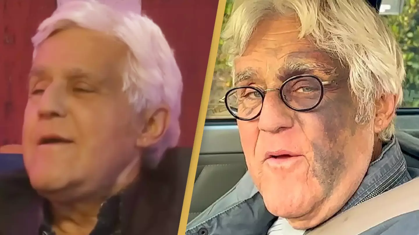Jay Leno addresses rumors that he was 'beaten by the mob' following concern from fans over major face injuries