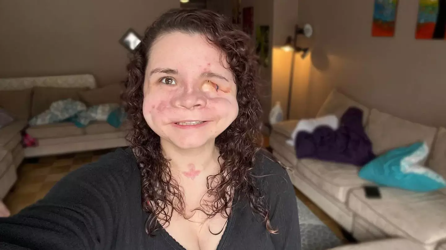 Woman given ‘less than 2%’ chance of survival after being shot in the face shares important message about horrific trauma