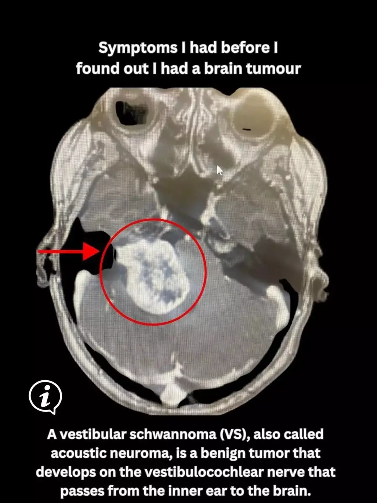 Tamara's tumor wasn't just huge, it was gigantic (Tamara Bright/Kennedy News Media)