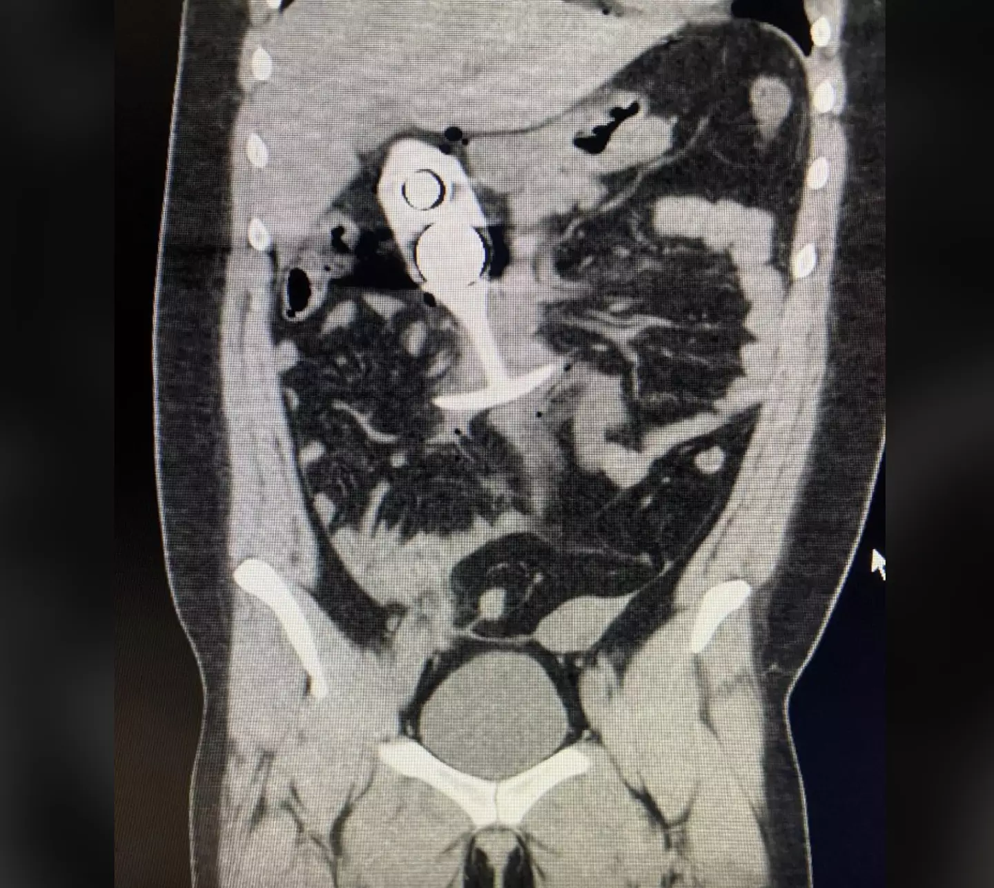 The scan showed the alleged butt plug (