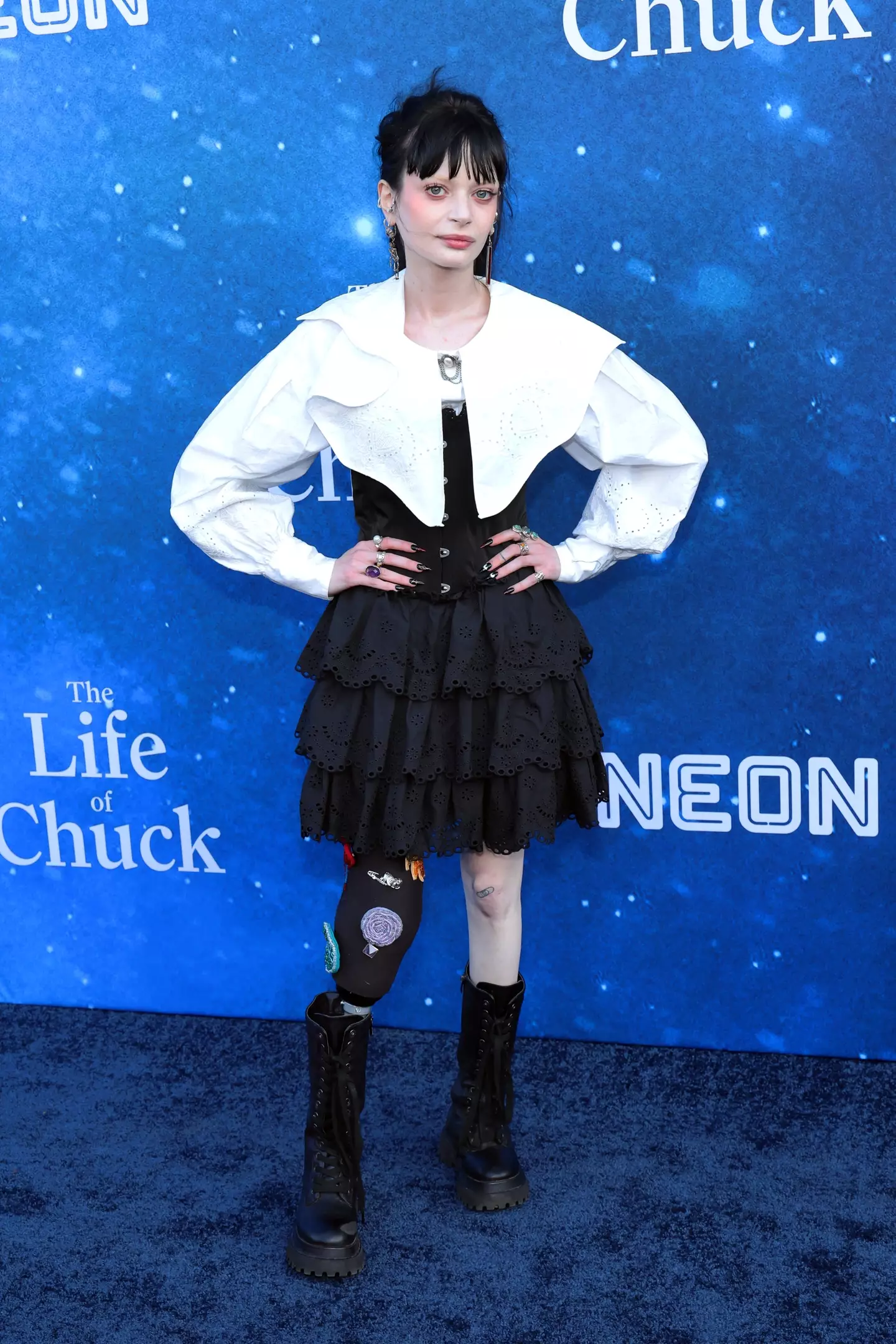 The Netflix star recently said she's had her second leg amputated below the knee (Amy Sussman/Getty Images)