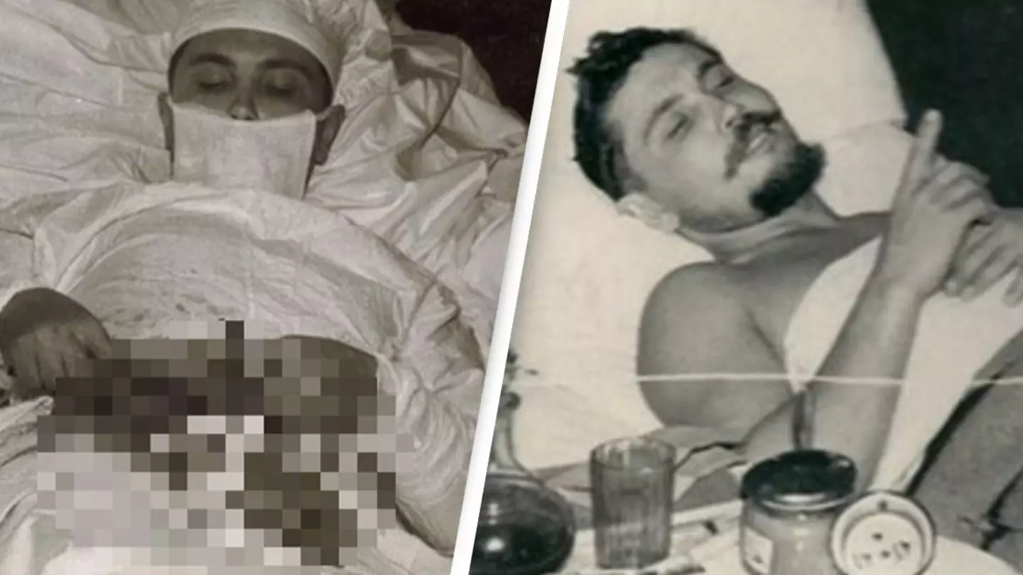 Man who was the only doctor on his team had to remove his own appendix and miraculously survived