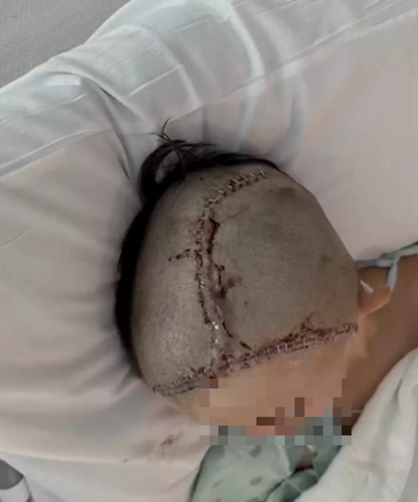 The 14-year-old teenager was allegedly attacked in his school cafeteria (KBTX)