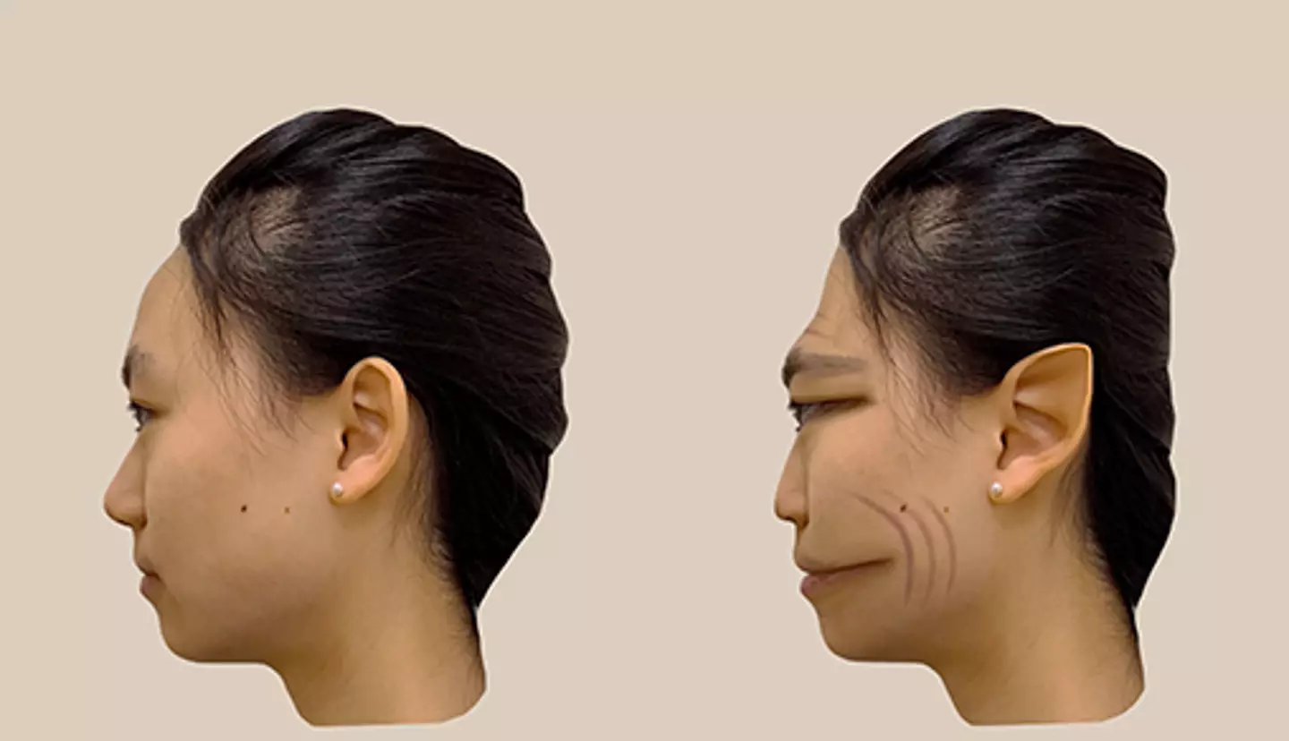 Not everyone sees the distortions the same way (Antonio Mello/The Lancet)