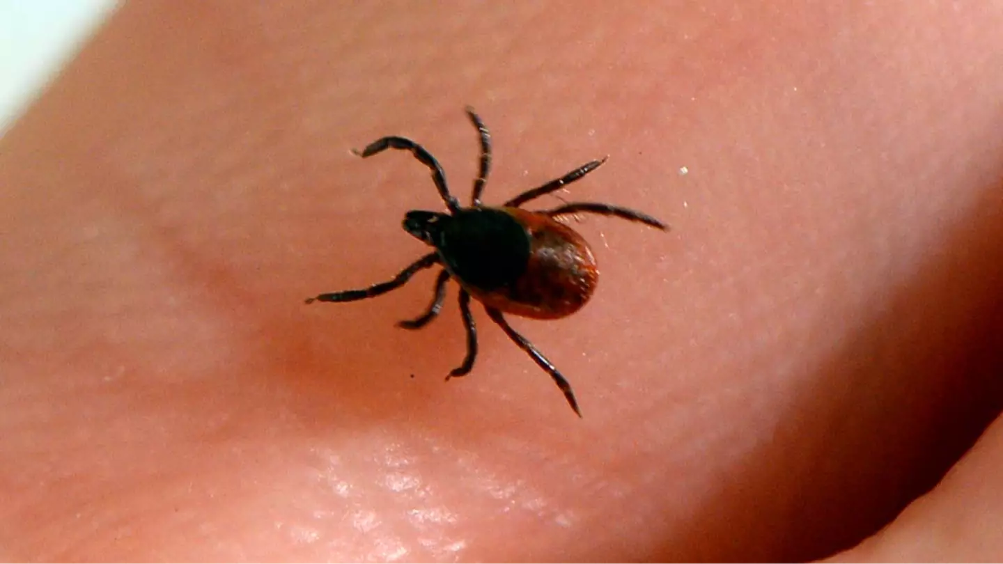 Doctor issues warning over hidden symptoms of Lyme disease as tick bites near record highs in US states