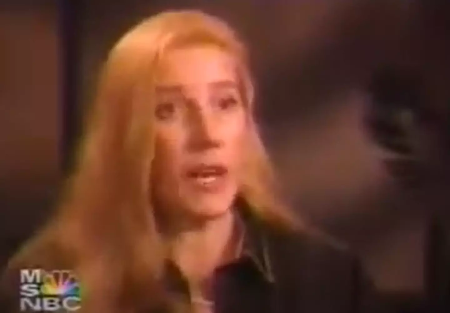 Her eyes were taped shut and she had headphones on for the procedure (NBC)