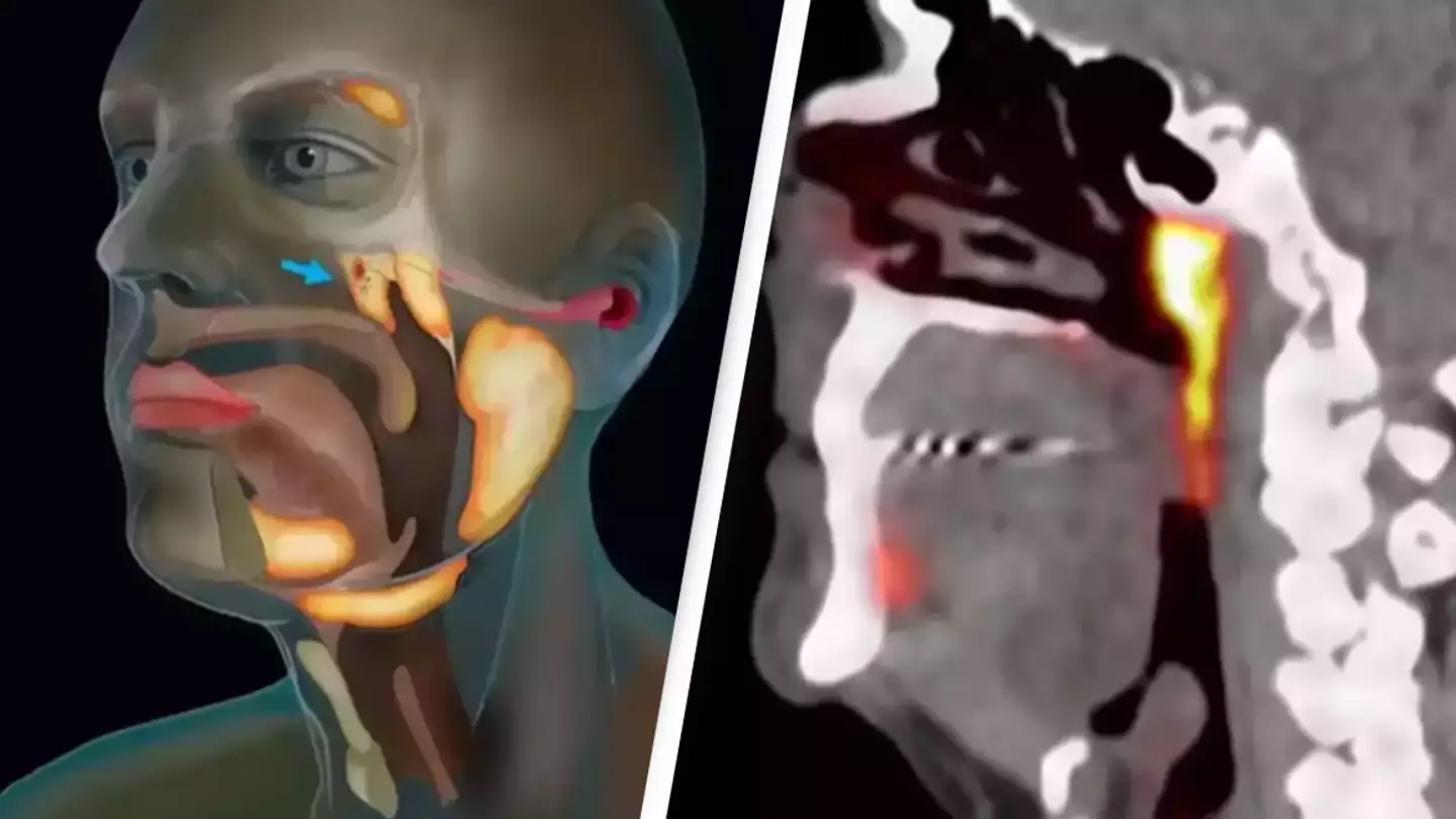 Netherlands Cancer Institute/YouTube/Antoni Van Leeuwenhoek