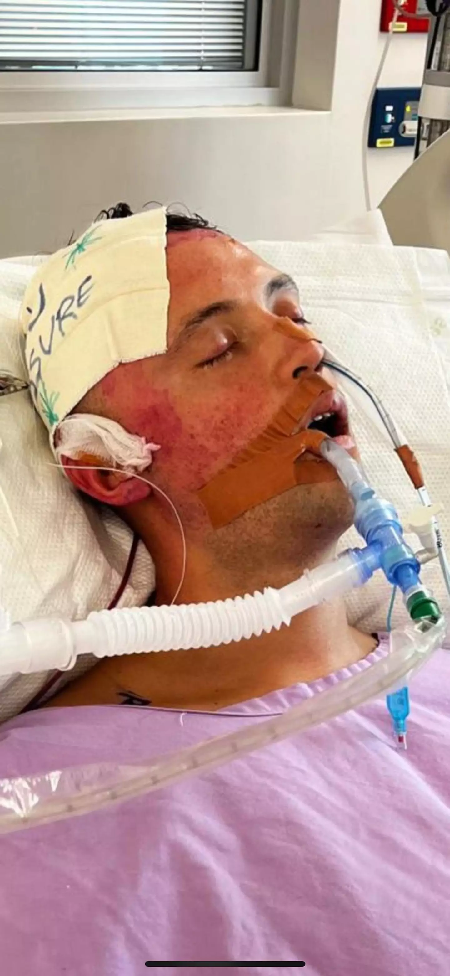 Liam was left fighting for his life after the health scare on November 11 (Kennedy News and Media)