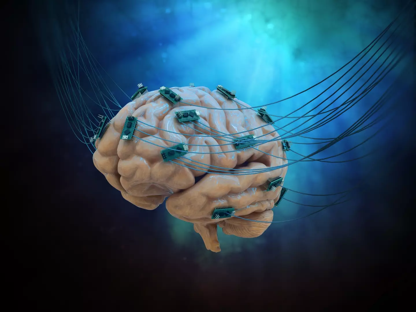 Six paralysed people will be given brain implants in the US.