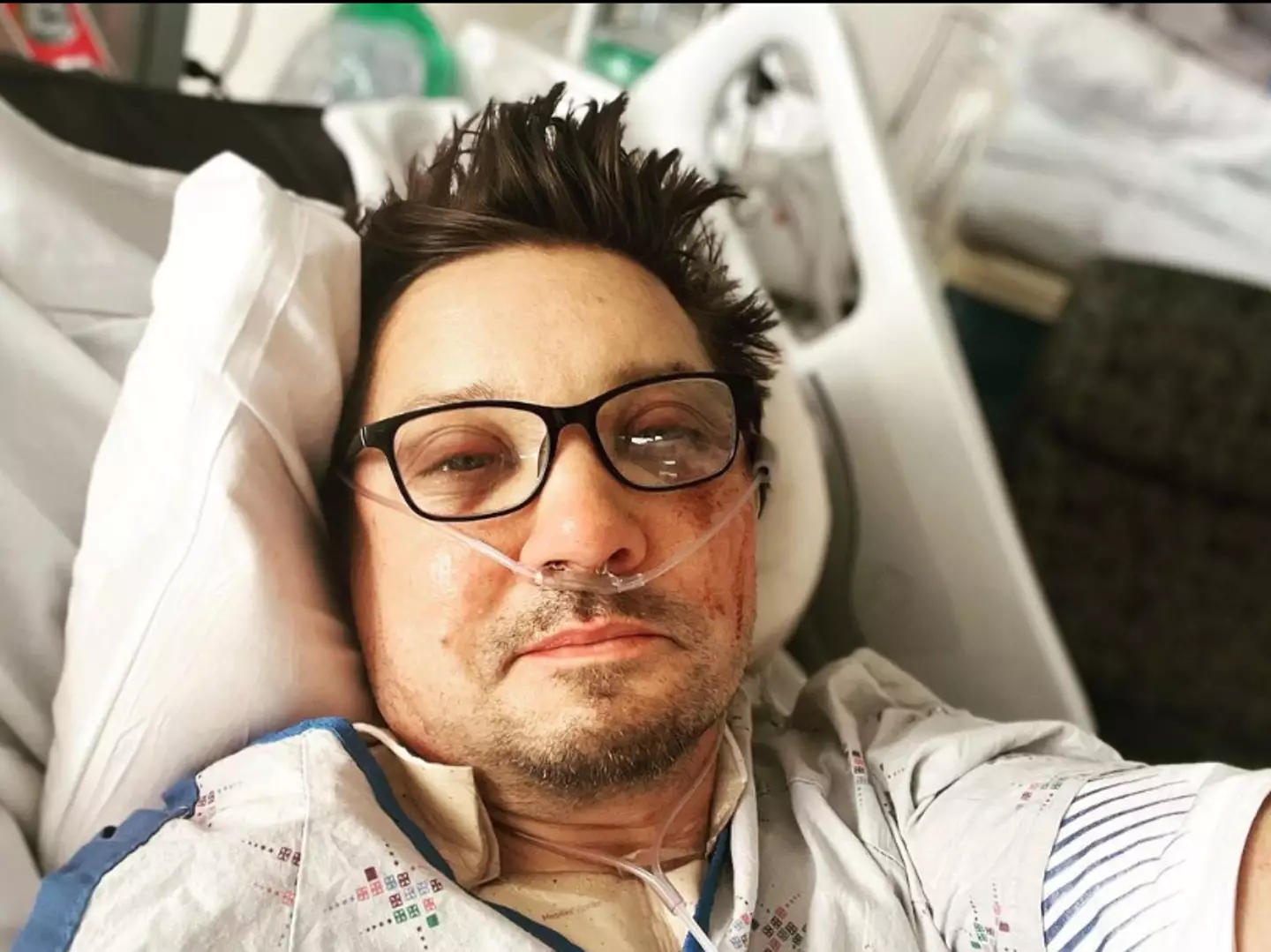 Jeremy Renner was hospitalised in the accident.