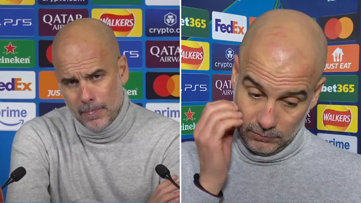 Pep Guardiola explains why he had scratches all over his face during interview after Man City's collapse against Feyenoord