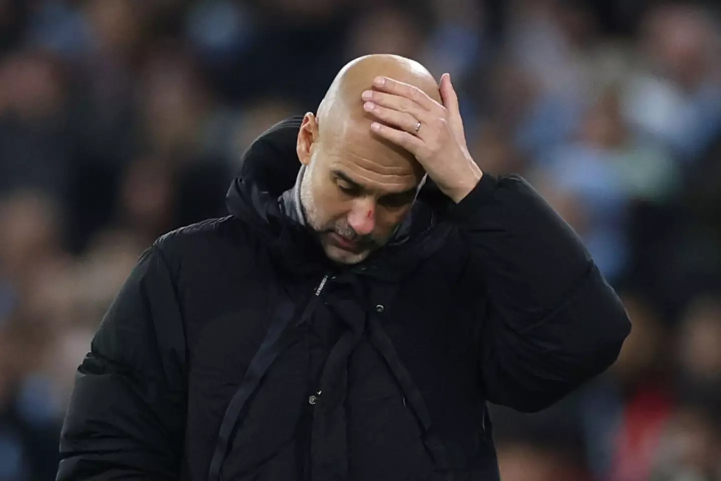 Pep Guardiola could be seen with a cut on his nose during Man City's Champions League match against Feyenoord. (Image: Getty)