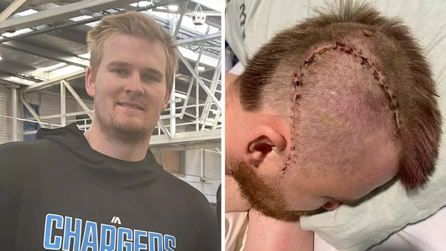 Extent of Aussie basketball star's injuries from alleged shocking one-punch attack revealed