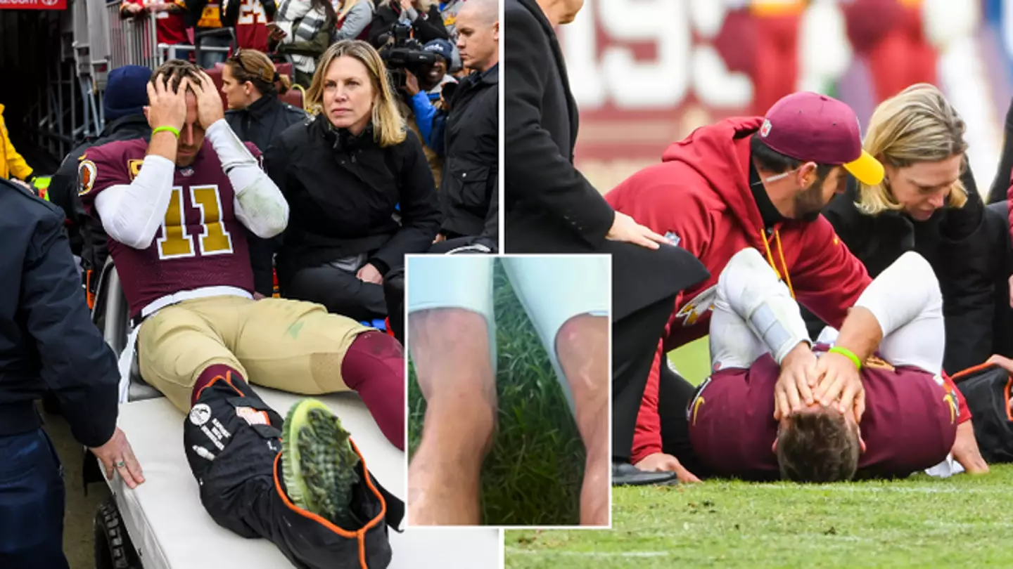 NFL legend Alex Smith shocks fans after posting picture of his leg