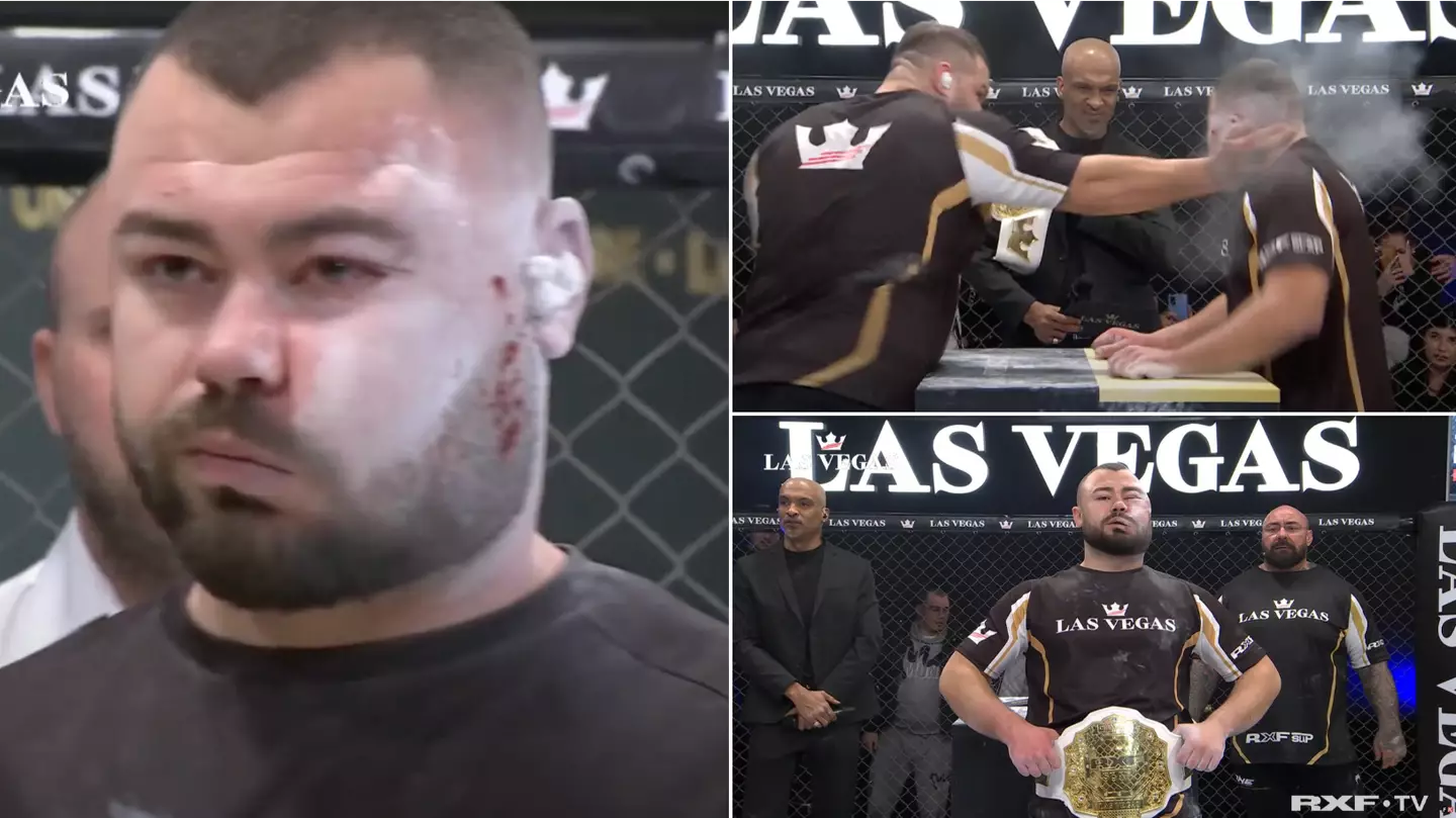 Man's face is disfigured after brutal slapping contest, still somehow wins championship