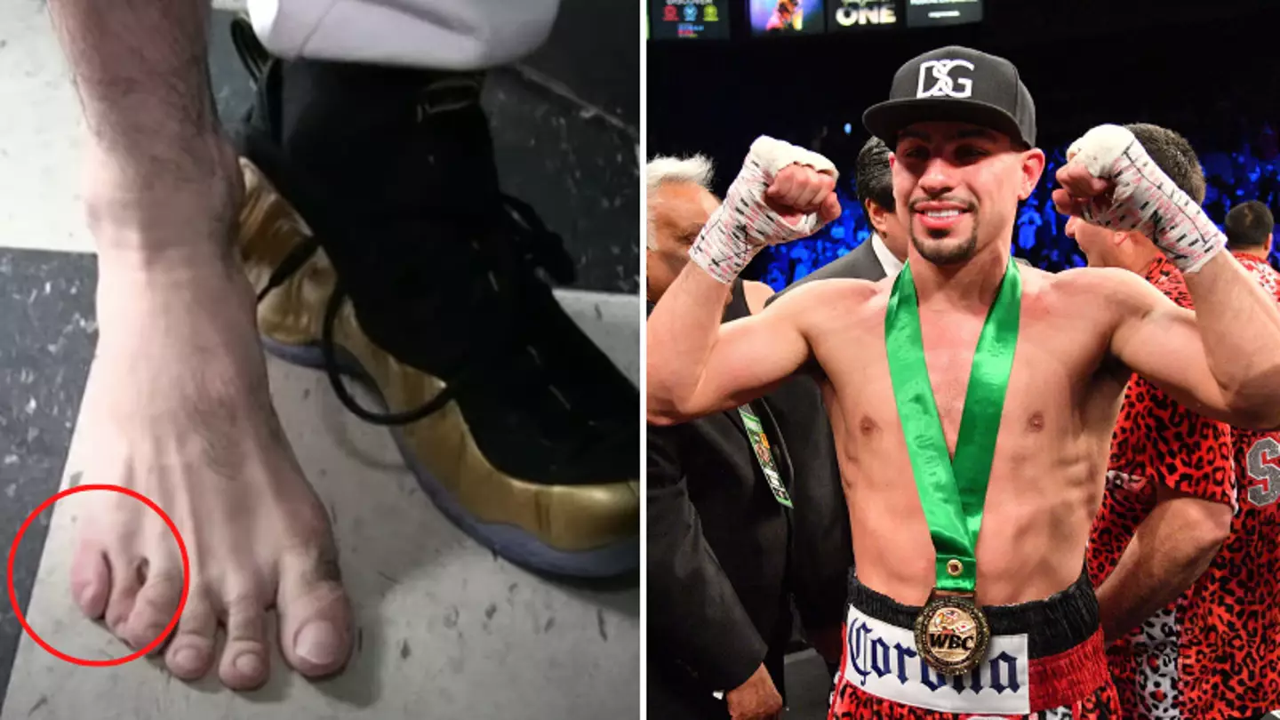 Former World Champion Boxer Has ELEVEN Toes And Says It Gives Him An Advantage in The Ring
