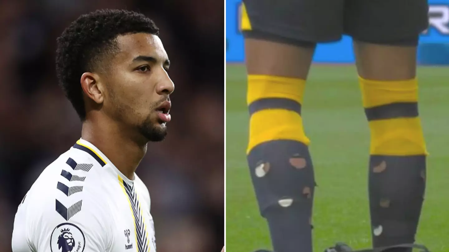 Everton Physio Cuts Holes In Mason Holgate's Socks During Premier League Clash Against West Ham