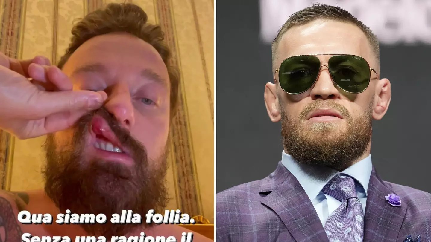 'Go Speak To A Professional' - UFC Legend Brutally Slams 'Bully' Conor McGregor For Allegedly Punching Italian DJ