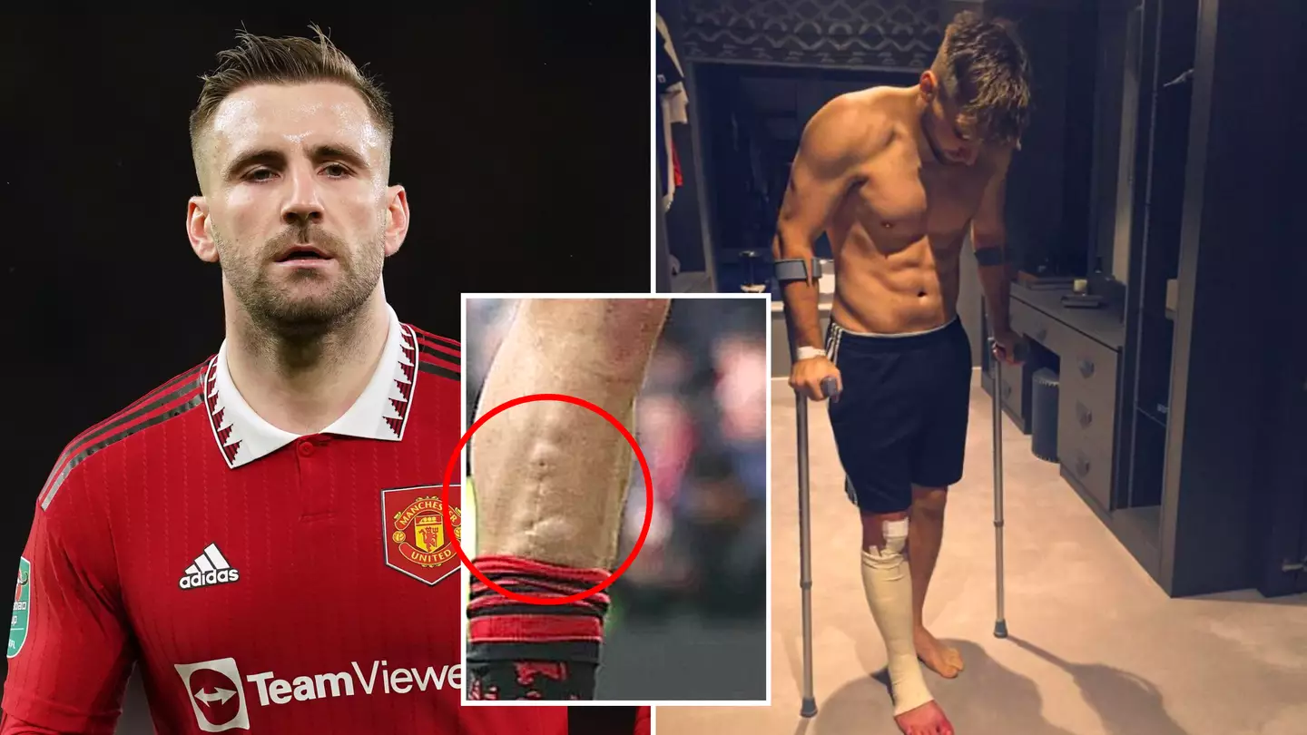 The story behind Luke Shaw's leg scar could make his Man Utd comeback one of the greatest ever