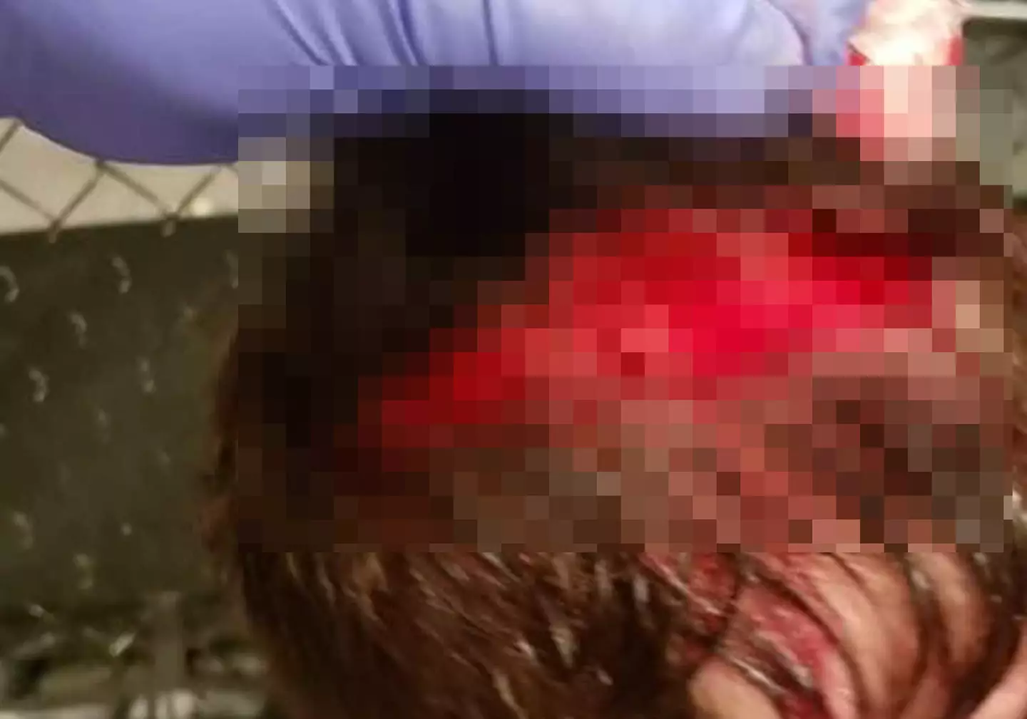 Boone suffered the injury in the opening moments of his fight (Image: MyMMANews)