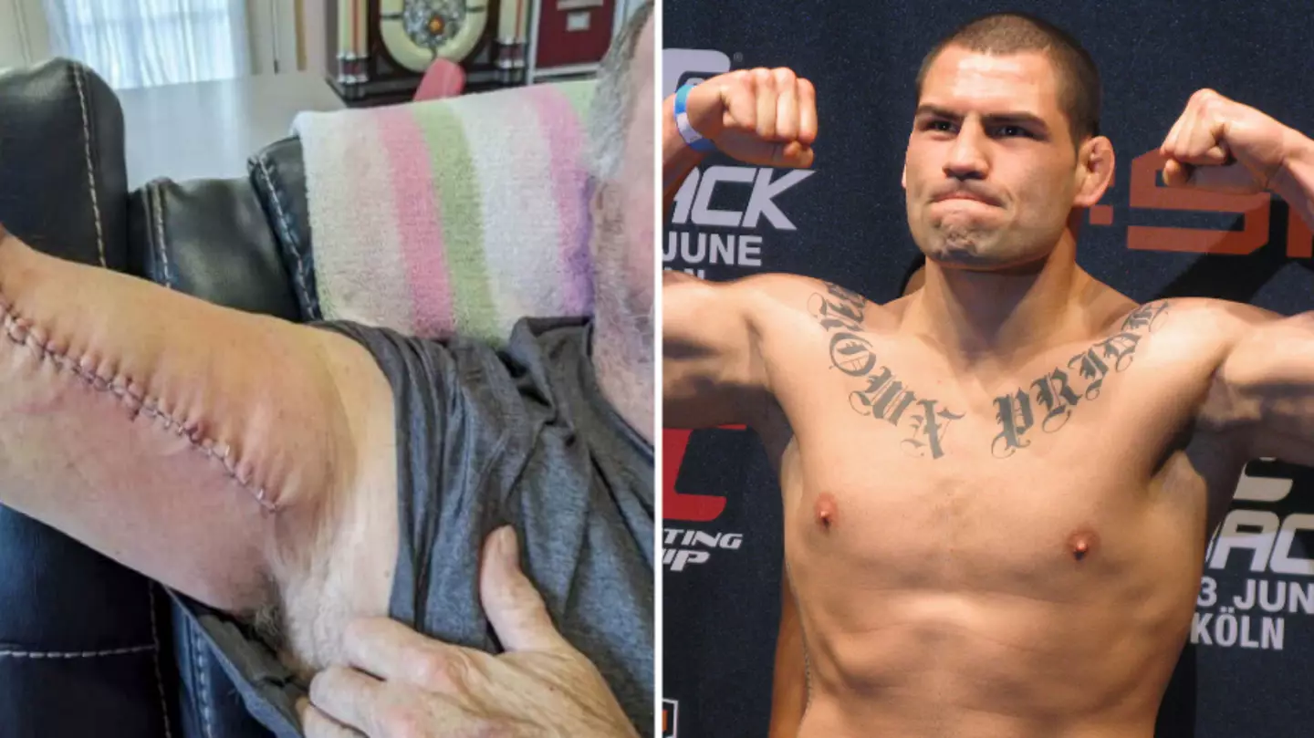 Cain Velasquez Denied Bail As Shooting Victim Shows Off Huge Scar