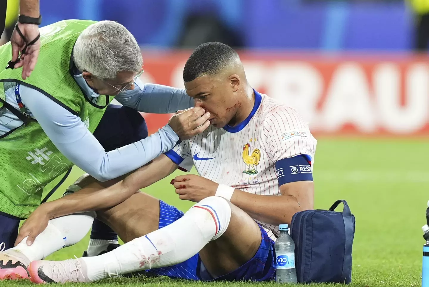 Kylian Mbappe receives treatment on his nose. Image: Getty