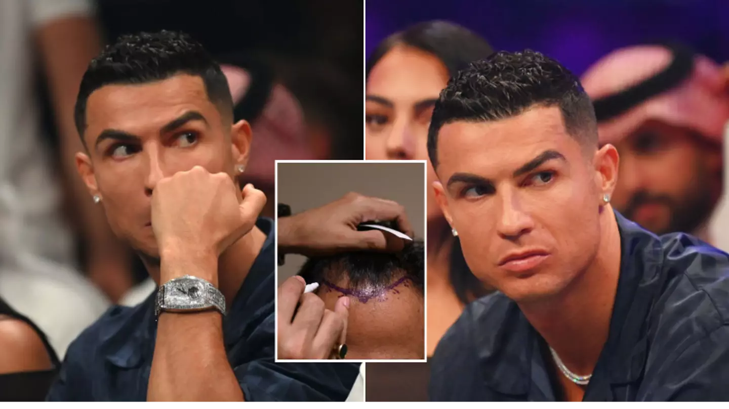 Cristiano Ronaldo hair transplant clinics are under investigation by Spanish authorities