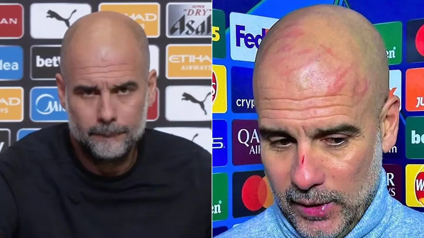 Pep Guardiola breaks his silence to reveal the real reason for the scratches on his head