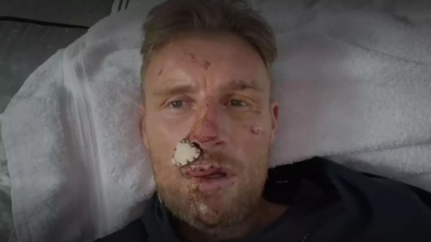 Full extent of Freddie Flintoff's injuries after horrific Top Gear crash shown in never-before-seen photos