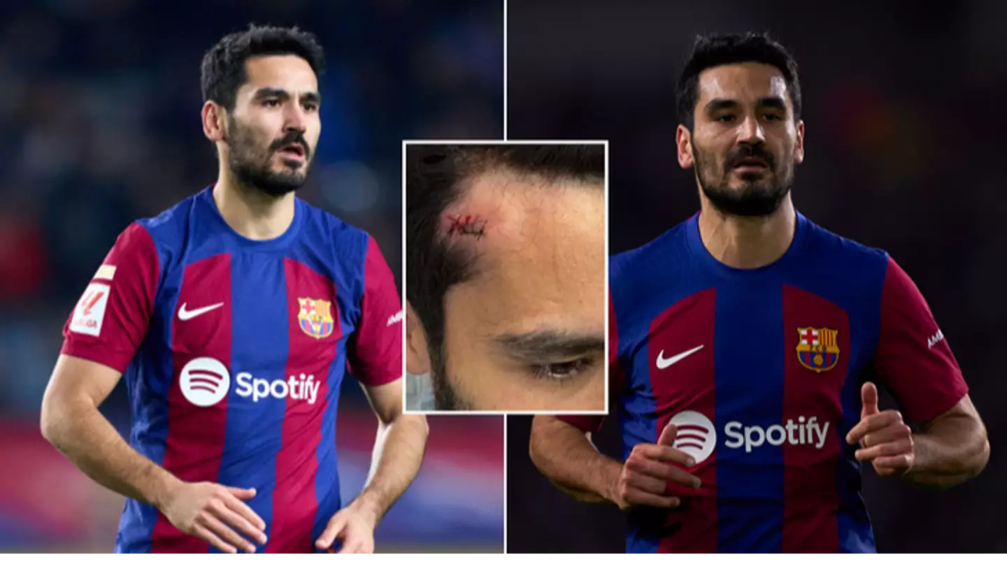 Ilkay Gundogan forced to spend time in hospital to end 2023 after bizarre incident