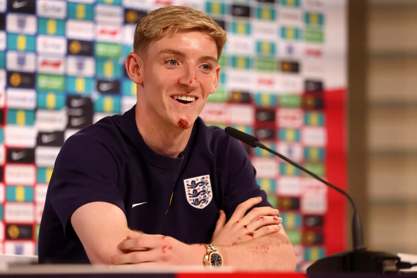 Anthony Gordon's injuries are shown during his press conference (Getty)