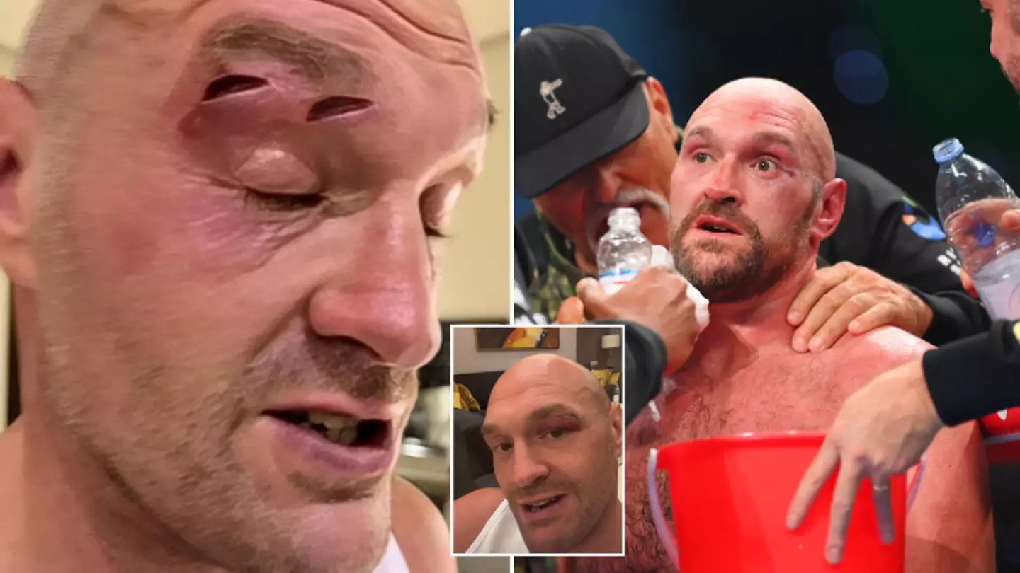 Tyson Fury may never 'fight again' after postponing Oleksandr Usyk fight, claims former champion